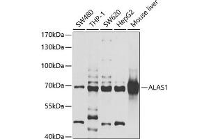 Western blot analysis of extracts of various cell lines, using  antibody (ABIN6129895, ABIN6136754, ABIN6136756 and ABIN6222177) at 1:1000 dilution. (ALAS1 Antikörper  (AA 1-250))