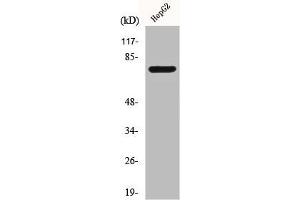 Western Blot analysis of Jurkat cells using CLIP4 Polyclonal Antibody (CLIP4 Antikörper  (Internal Region))