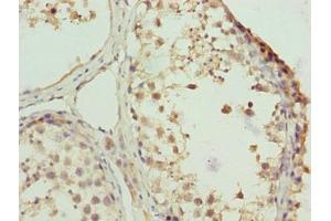Immunohistochemistry of paraffin-embedded human testis tissue using ABIN7176109 at dilution of 1:100 (ZNF131 Antikörper  (AA 80-379))