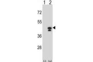 Western Blotting (WB) image for anti-Phosphoglycerate Kinase 1 (PGK1) antibody (ABIN2995252) (PGK1 Antikörper)