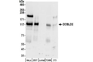 anti-Discoidin, CUB and LCCL Domain Containing 2 (DCBLD2) (AA 725-775) antibody