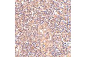 Immunohistochemistry of ATM in human lymph node tissue with ATM polyclonal antibody  at 2.