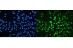 IF analysis of MBD4/MED1 using anti-MBD4/MED1 antibody (ABIN7600185).