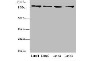 Western blot analysis of (1) HeLa whole cell lysate, (2) Mouse heart tissue, (3) HepG-2 whole cell lysate and (4) Jurkat whole cell lysate, using TNNI3K antibody (4.