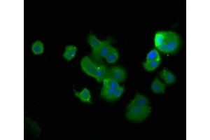 Immunofluorescence staining of MCF-7 cells with ABIN7173373 at 1:400, counter-stained with DAPI. (TCHP Antikörper  (AA 1-498))