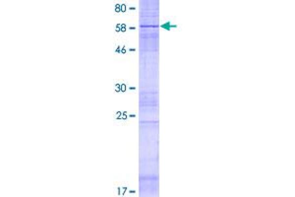 PTPLAD1 Protein (AA 1-362) (GST tag)