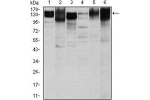 Western Blotting (WB) image for anti-Integrin beta 1 (ITGB1) antibody (ABIN1106231) (ITGB1 Antikörper)