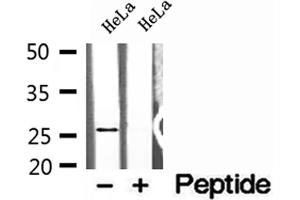 Western blot analysis of extracts of HeLa cells, using NUDT21 antibody.