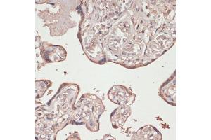 Immunohistochemistry of paraffin-embedded human placenta using Thioredoxin reductase 1 (Thioredoxin reductase 1 (TXNRD1 ) ) antibody (ABIN7270806) at dilution of 1:100 (40x lens). (TXNRD1 Antikörper)