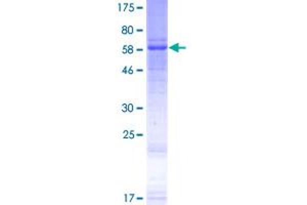 WNT5A Protein (AA 1-380) (GST tag)