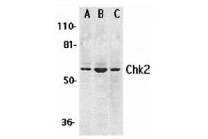 Western Blotting (WB) image for anti-Checkpoint Kinase 2 (CHEK2) (N-Term) antibody (ABIN1031318) (CHEK2 Antikörper  (N-Term))