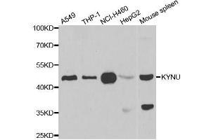 Western blot analysis of extracts of various cell lines, using KYNU antibody. (KYNU Antikörper  (AA 1-307))