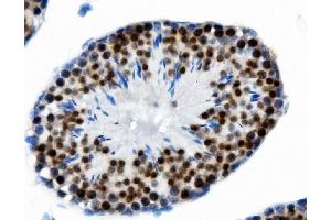 IHC analysis of PTBP2 using anti-PTBP2 antibody (ABIN7599453).