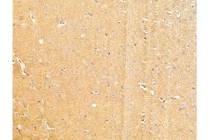 ABIN7094805 and ABIN7098856 at 1/100 staining Rat brain tissue by IHC-P. (MCT3 Antikörper  (C-Term))