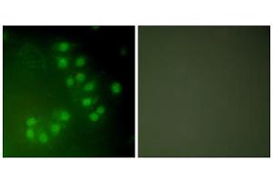 Immunofluorescence analysis of A549 cells, using p63 antibody (ABIN5976481). (TCP1 alpha/CCTA Antikörper  (C-Term))