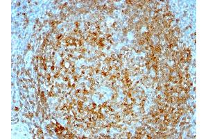 Formalin-fixed, paraffin-embedded human Tonsil stained with CD74 Mouse Monoclonal Antibody (CLIP/813). (CD74 Antikörper)