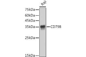 Western blot analysis of extracts of Raji cells, using CD79B antibody (ABIN1682474, ABIN3018855, ABIN3018856 and ABIN7101674) at 1:1000 dilution. (CD79b Antikörper)