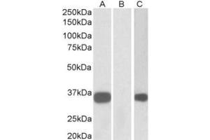 Western Blotting (WB) image for anti-Kv Channel Interacting Protein 3, Calsenilin (KCNIP3) (N-Term) antibody (ABIN2465094) (DREAM Antikörper  (N-Term))