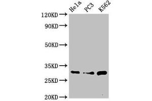 Western Blot Positive WB detected in: Hela whole cell lysate, PC-3 whole cell lysate, K562 whole cell lysate All lanes: PSMA1 antibody at 3. (PSMA1 Antikörper  (AA 163-263))