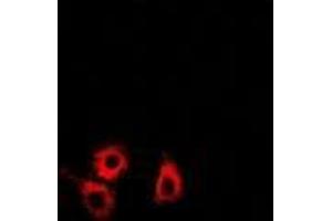 Immunofluorescence (IF) image for anti-SET and MYND Domain Containing 4 (SMYD4) (AA 1-260) antibody (ABIN6004721) (SMYD4 Antikörper  (AA 1-260))