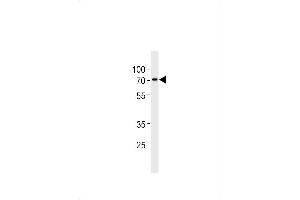 ST7L Antikörper  (C-Term)