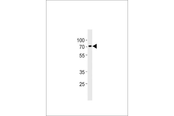 ST7L Antikörper  (C-Term)