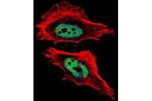Fluorescent confocal image of HeLa cells stained with CTBP1 antibody. (CTBP1 Antikörper  (AA 413-440))