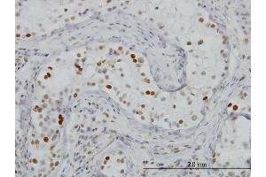 Immunoperoxidase of monoclonal antibody to BRD3 on formalin-fixed paraffin-embedded human testis. (BRD3 Antikörper  (AA 418-556))