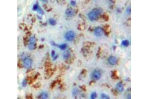 IHC-P analysis of Liver tissue, with DAB staining. (CYP1A1 Antikörper  (AA 1-250))