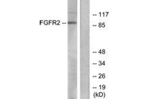 Western blot analysis of extracts from A549 cells, using FGFR2 Antibody. (FGFR2 Antikörper  (AA 471-520))