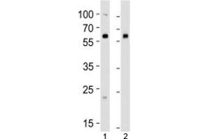 Western blot analysis of lysate from 1) human 293 and 2) mouse NIH3T3 cell line using BMPR1A antibody at 1:1000. (BMPR1A Antikörper  (AA 166-196))