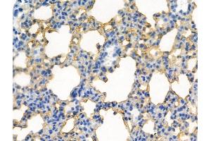 Phospho-CDK5 (Tyr239) Antibody at 1/100 staining Mouse lung tissue by IHC-P. (CDK5 Antikörper  (pTyr239))