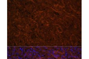 Immunofluorescence analysis of Human spleen using ICOS Polyclonal Antibody at dilution of 1:100. (ICOS Antikörper)
