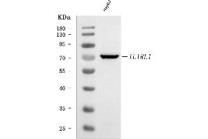 Western blot analysis of ST2/IL1RL1 using anti-ST2/IL1RL1 antibody (ABIN7602351).