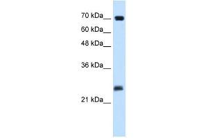 Human Placenta; WB Suggested Anti-SERTAD1 Antibody Titration: 0. (SERTAD1 Antikörper  (N-Term))