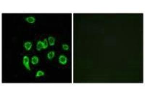 Immunofluorescence analysis of A549 cells, using MRPL32 antibody. (MRPL32 Antikörper)