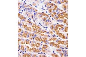 Immunohistochemical analysis of paraffin-embedded H. (VAMP8 Antikörper  (N-Term))