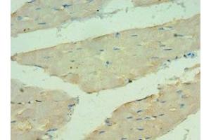 Immunohistochemistry of paraffin-embedded human skeletal muscle tissue using ABIN7144121 at dilution of 1:100 (ANGPTL4 Antikörper  (AA 26-406))