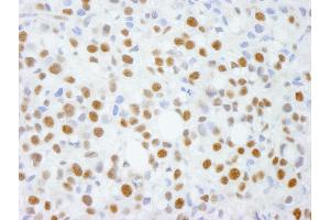 Immunohistochemistry (IHC) image for anti-Activity-Dependent Neuroprotector Homeobox (ADNP) (C-Term) antibody (ABIN7448403) (ADNP Antikörper  (C-Term))