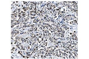 IHC analysis of PCBP1 using anti-PCBP1 antibody (ABIN7600127).
