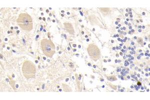 Detection of GSTM2 in Human Cerebellum Tissue using Polyclonal Antibody to Glutathione S Transferase Mu 2 (GSTM2) (GSTM2 Antikörper  (AA 3-218))