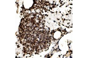 IHC analysis of RCC1 using anti-RCC1 antibody (ABIN7600024).