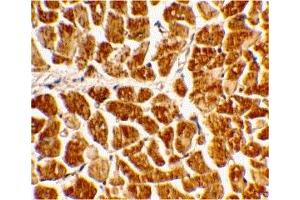 Immunohistochemistry (IHC) image for anti-Chemokine (C-X3-C Motif) Receptor 1 (CX3CR1) (N-Term) antibody (ABIN1031335) (CX3CR1 Antikörper  (N-Term))