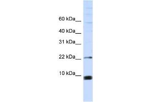 WB Suggested Anti-SNRPF Antibody Titration:  0. (SNRPF Antikörper  (Middle Region))