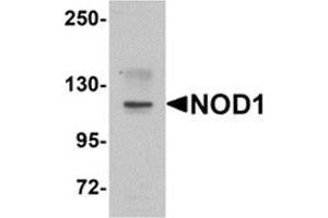 Western blot analysis of NOD1 in EL4 cell lysate with NOD1 antibody at 1 μg/ml. (NOD1 Antikörper  (C-Term))