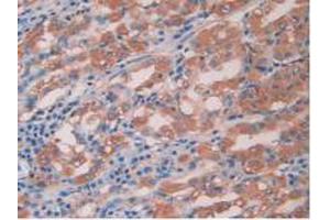 IHC-P analysis of Human Stomach Tissue, with DAB staining. (IL-15 Antikörper  (AA 50-162))