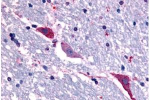 Anti-TACR3 antibody  ABIN1049392 IHC staining of human brain, hippocampus. (TACR3 Antikörper  (C-Term))