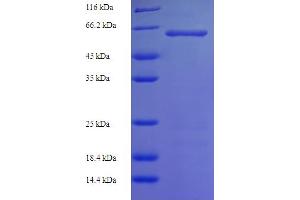 SDS-PAGE (SDS) image for serine/threonine Kinase 25 (STK25) (AA 1-426), (full length) protein (His-SUMO Tag) (ABIN5710428) (STK25 Protein (AA 1-426, full length) (His-SUMO Tag))