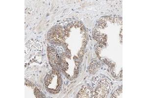 Immunohistochemical staining of human prostate with YIPF7 polyclonal antibody  shows moderate cytoplasmic positivity with a granular pattern in glandular cells. (YIPF7 Antikörper)