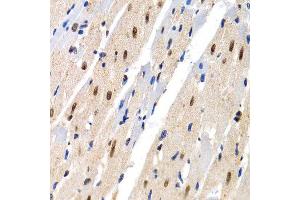 Immunohistochemistry of paraffin-embedded rat heart using MT2A antibody at dilution of 1:200 (400x lens). (MT2A Antikörper)